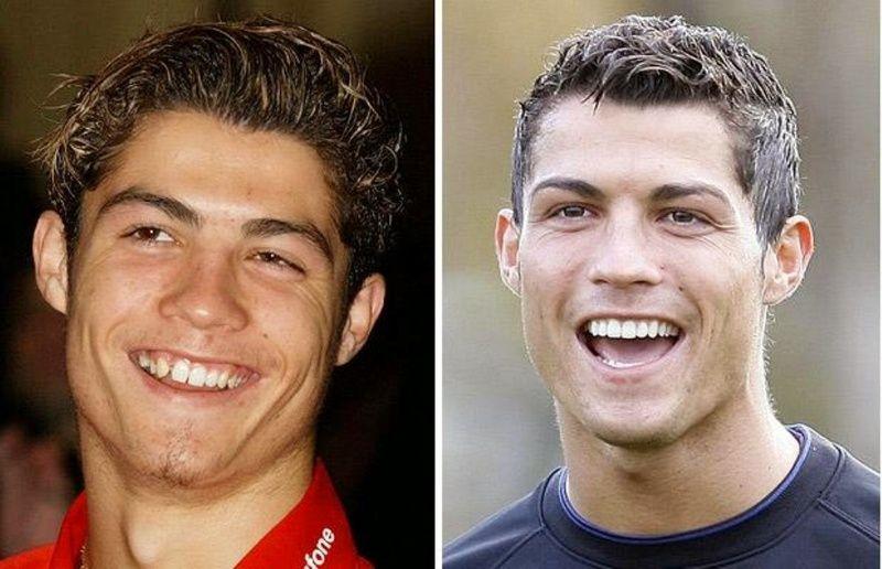 
   Cristiano Ronaldo seems to have fixed the gaps in his teeth 
 