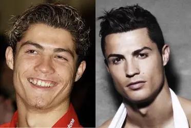 Cristiano Ronaldo's looks have changed over the years, with many rumours that he has undergone numerous plastic surgeries. A cosmetic surgeon points out the evidence.
