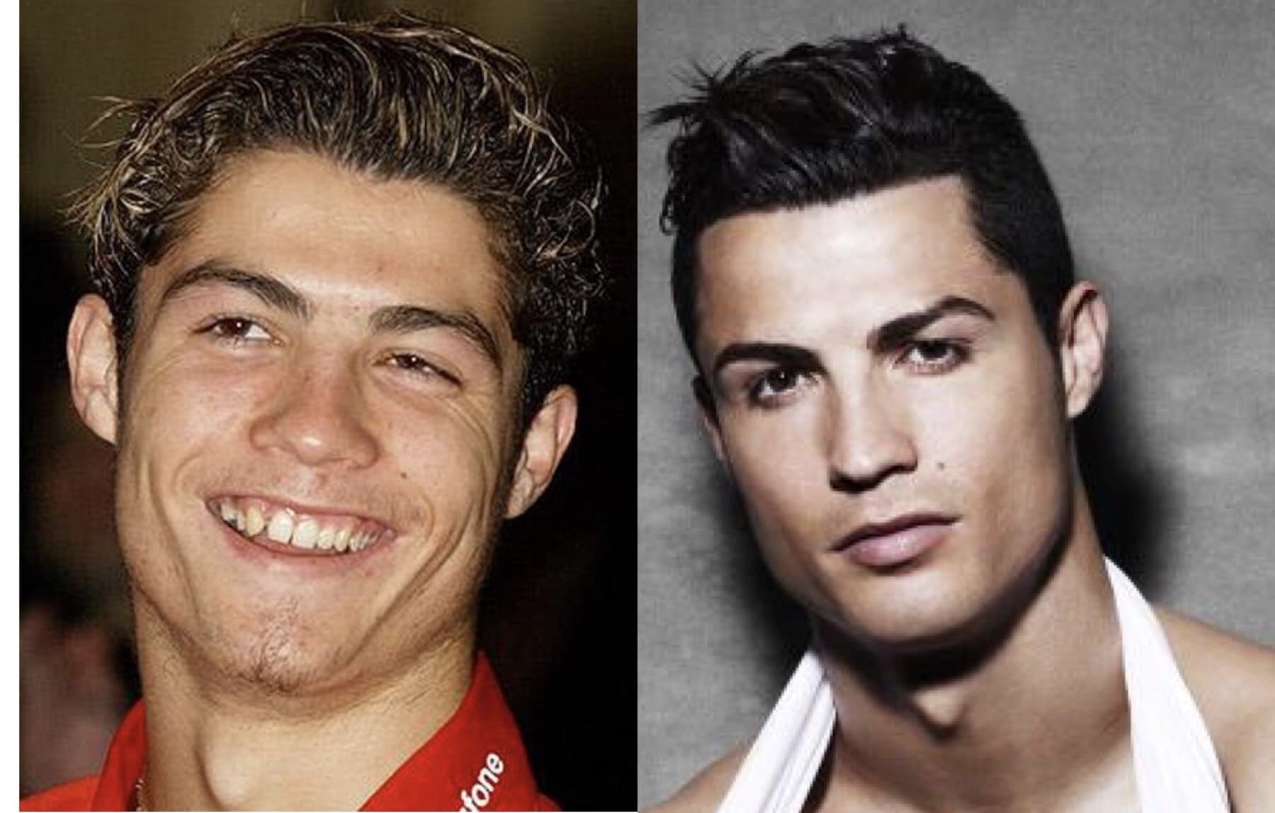 Cristiano Ronaldo's looks have changed over the years, with many rumours that he has undergone numerous plastic surgeries. A cosmetic surgeon points out the evidence.