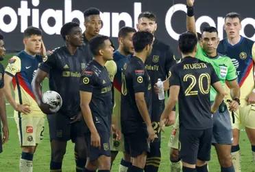 LAFC defeated America a few years ago in the Concacaf Champions League