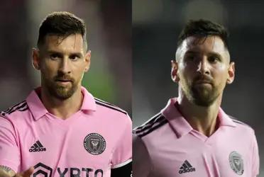 Lionel Messi left the game injured and worries Inter Miami