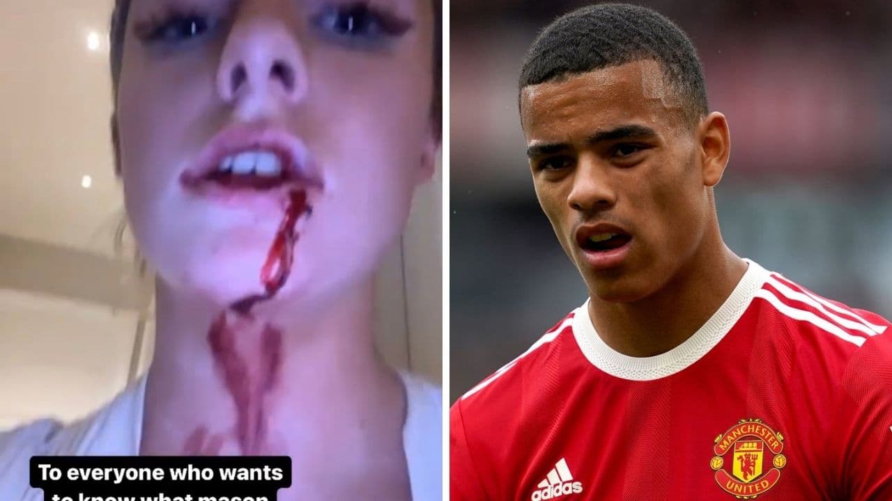 Mason Greenwood is in trouble over controversial allegations after his girlfriend, Harriet Robson, posted several photographs on her Instagram profile with serious injuries that the Manchester United player allegedly caused her.